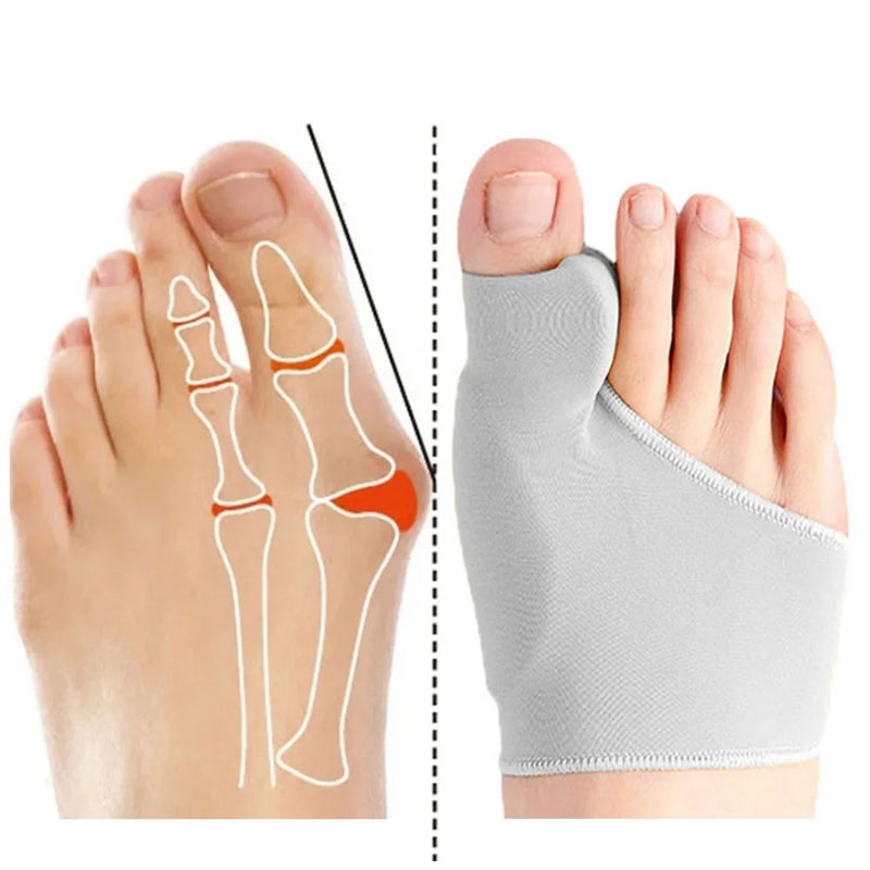 Trek - Bunion Corrector